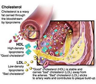 Transports cholesterol to the cells Contributes to plaques igh levels