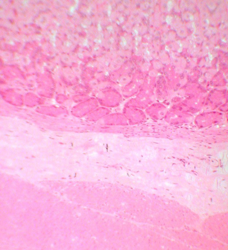 (d) Submucosa 1. Extends up into rugae. 2. Mostly dense C.