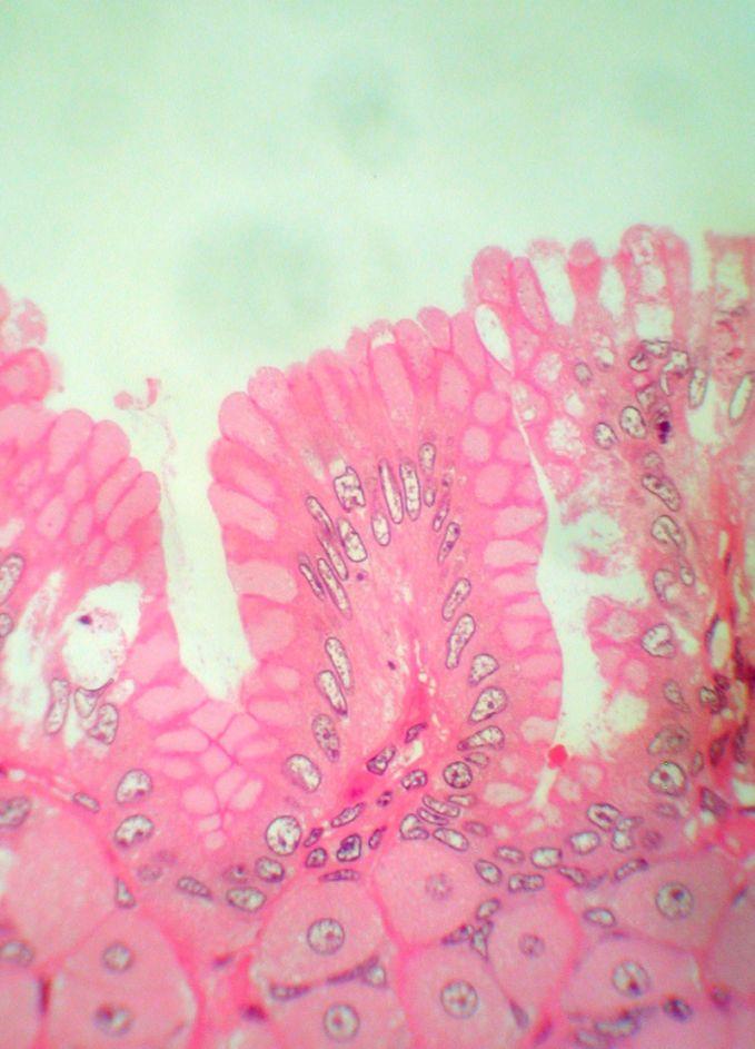 d. Below neck of gland, cells include the other 3 types.