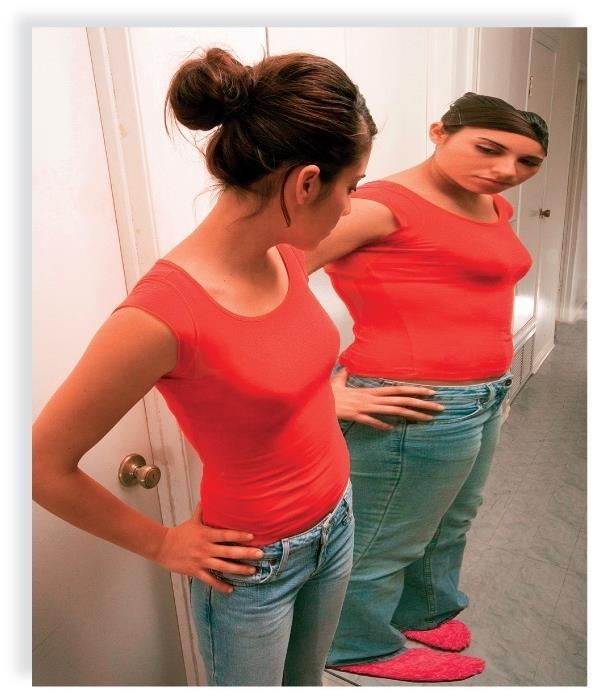 9.6 Nutrition and Weight Control Eating disorders are