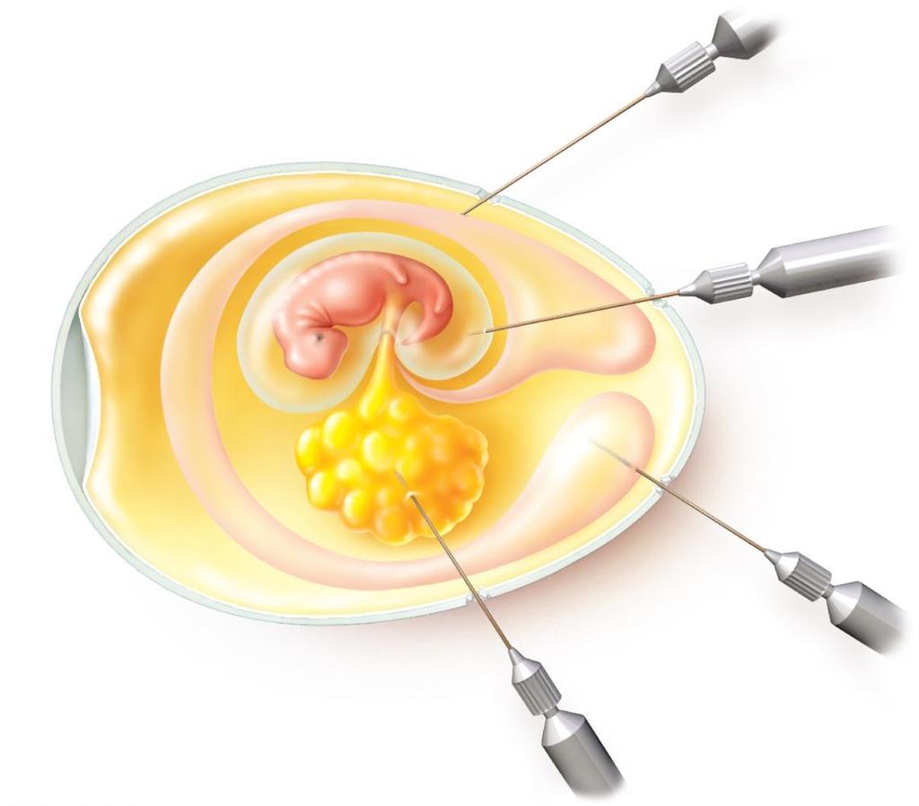 Figure 13.7 Inoculation of an embryonated egg.