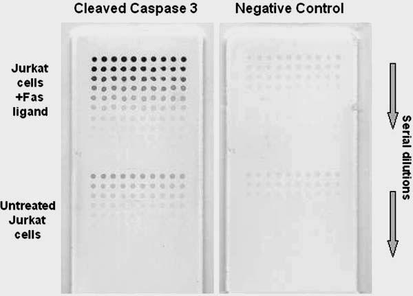 teins and pathways modulate apoptosis, protein microarrays are ideally suited to assay these pathways and determine which are functionally active in a neoplastic cell population (Figure 6) in order