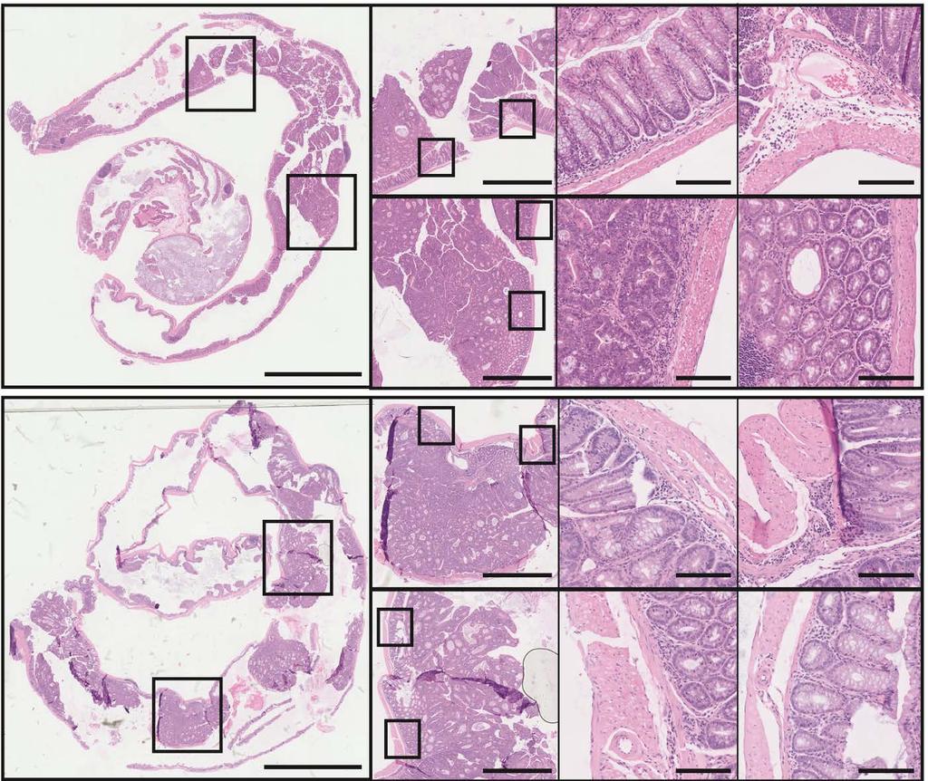 a b Fgure S12 Hstology of colorectal tssue from AOM/DSS treated mce fed wth Eda-1. a. Tssue secton from mouse treated wth AOM/DSS and fed wth Eda-1 and sngrn, scale bar: 5 mm. b. Tssue secton from mouse treated wth AOM/DSS and fed wth Eda-1 and broccol, scale bar: 5 mm (nset: boxes - ndcate 2x magnfcaton, scale bar: 500 μm.