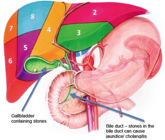 Anatomy of bile ducts Extrahepatic portion: Central Rt and Lt ducts, common bile duct Proximal duct: run anterior to the Rt and main PV and Rt HA