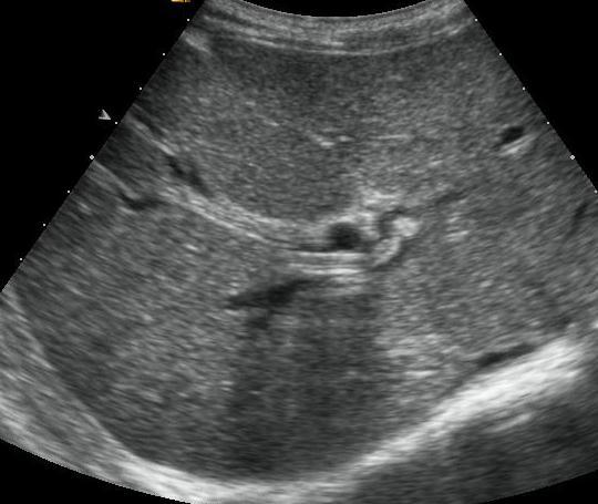 worm during the scan