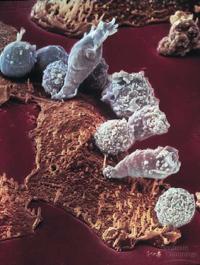 attacking cancer cell