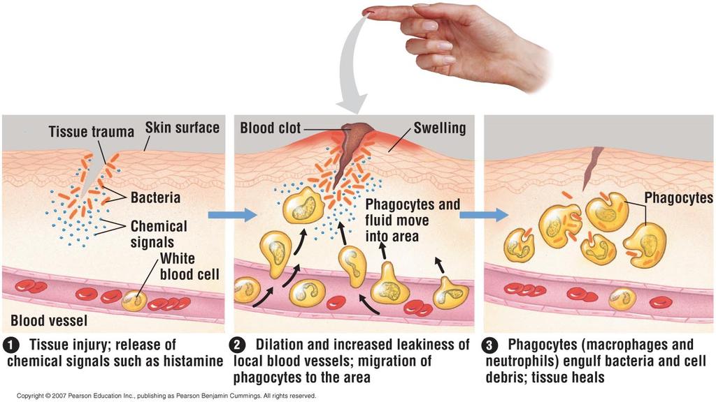 Phagocytes destroy bacteria Tissue heals Like Putting Up Signs & Opening Gates to Attract Help Histamine makes