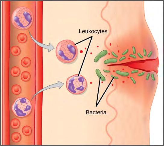 movement of leukocytes and fluid through increasingly permeable capillaries to a site of infection.