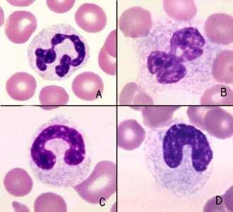Neutrophils 60% of WBCs Patrol tissues as they squeeze out of the capillaries.