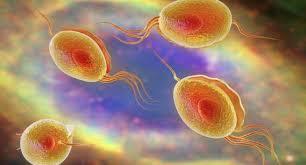 Trichomoniasis is considered the most common curable STD. an estimated 3.