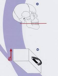 The appliance should be positioned similarly to the patient s head position during the patient scan, including the distance to the center of the FOV, the angle and