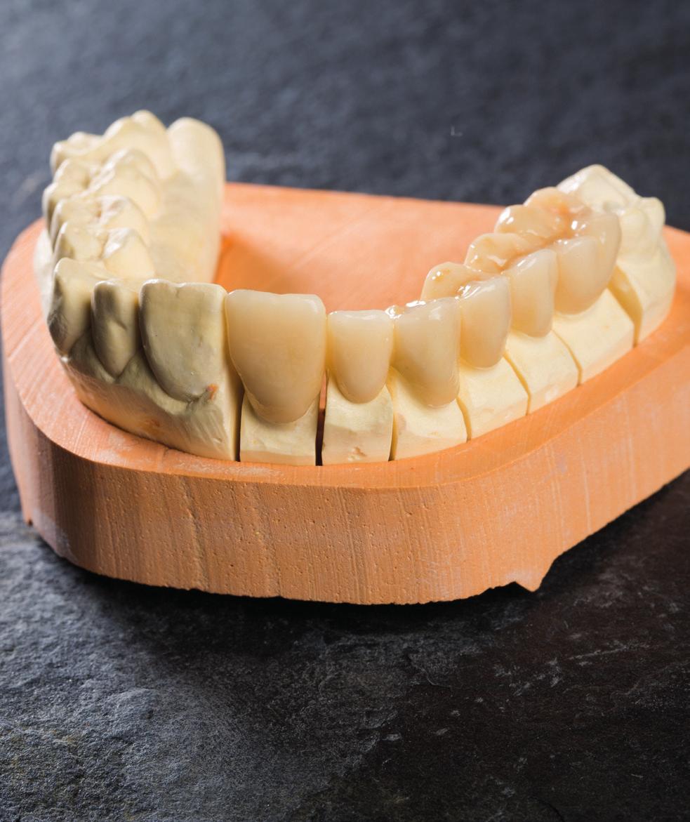 Indications Just one layer to create a bionic restoration Final treatment, up to three units Long-term temporaries with up to 16 units, lasting up to 2 years Permanent restoration Long-term