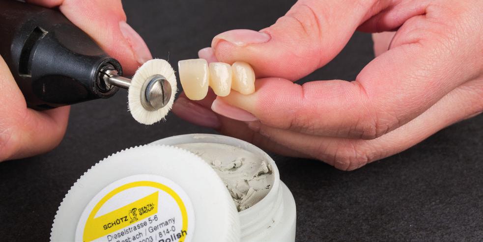 12 Expert opinion Milling and polishing Franziska Melius, Dental Technician Give your work its final shape