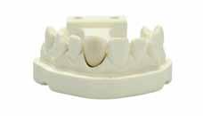 Efficient Saves time and cost The digital workflow for implant restorations 1