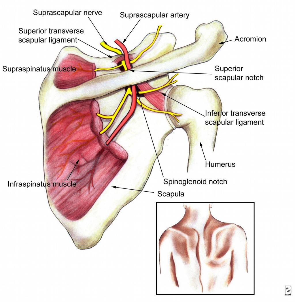 more proximal lesions of the suprascapular nerve that affect both the supraspinatus