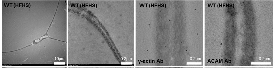 a b Caption Formation of zonula adherence in ACAM transgenic (Tg) mice associated with ACAM and γ actin. a. The distance of plasma membranes between adjacent adipocytes is ~100 200 nm in wild type (WT) mice fed with high fat, high sugar (HFHS) diet.