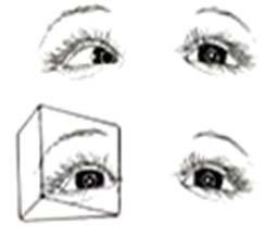 Diagnosing Strabismus Diagnosing Strabismus Krimsky s Test The strength of the prism required to center the corneal reflection in the eye with