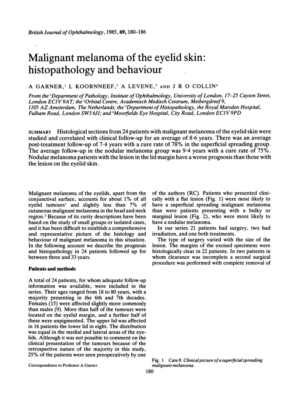 British Journal of Ophthalmology, 1985, 69, 180-186 Malignant melanoma of the eyelid skin: histopathology and behaviour A GARNER,' L KOORNNEEF,2 A LEVENE,3 AND J R 0 COLLIN4 From the 'Department of