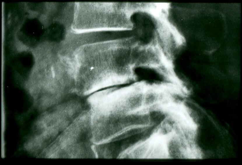 X-ray appearance of