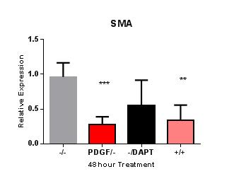 Supplemental Data: SMMHC 2 15 1 5 5 4 3 2 1 ** *** -/- PDGF/- -/DAPT +/+ 48 hour Treatment 4 3 2 1 ** -/- PDGF -/DAPT +/+ 48 hr Treatment 2 CNN1 2. NOTCH3 15 SMA 15 1 5 1.5 1..5 1 5 48 Hour Treatment.
