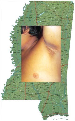 Mississippi s Big Problem. An Epidemic Now Reaching Our Children What Can We Do? Richard D. deshazo, MD Billy S.