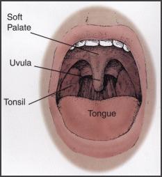 Tonsils and Adenoids Lymphoid tissue located on either side of the