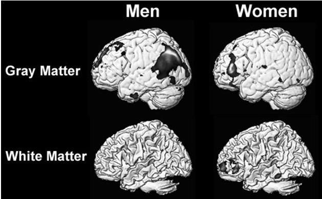 Regional differences with intelligence Brain difference in intelligence in males and females 84% of gray matter regions and 86 % of white matter regions involved in