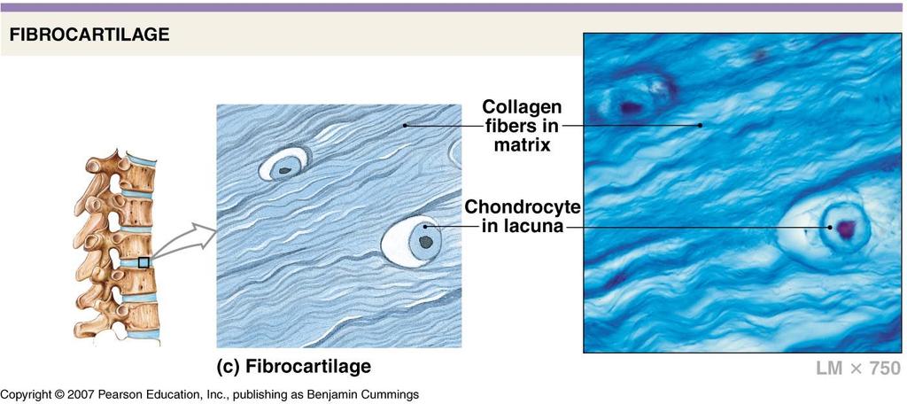 Fibrous Cartilage - Matrix has many thick parallel collagen fibers - Provides extreme strength - Fibrous cartilage is found in