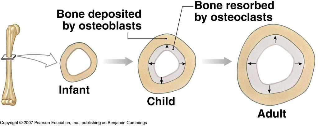 Appositional Growth of Long Bone Diaphysis Increased diameter of marrow cavity due to resorption by osteoclasts in