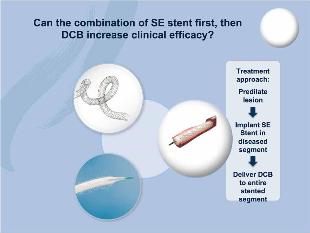 Can the combination of SE stent first, then DCB increase clinical efficacy?