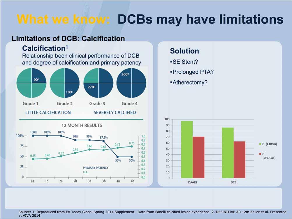 What we know: DCBs may have limitations Limitations of DCB: Calcification Calcification 1 Relationship been clinical performance of DCB and degree of calcification and primary patency Solution SE