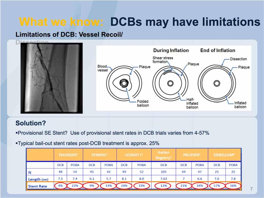 What we know: DCBs may have limitations Limitations of DCB: Vessel Recoil/ Dissection Solution? Provisional SE Stent?