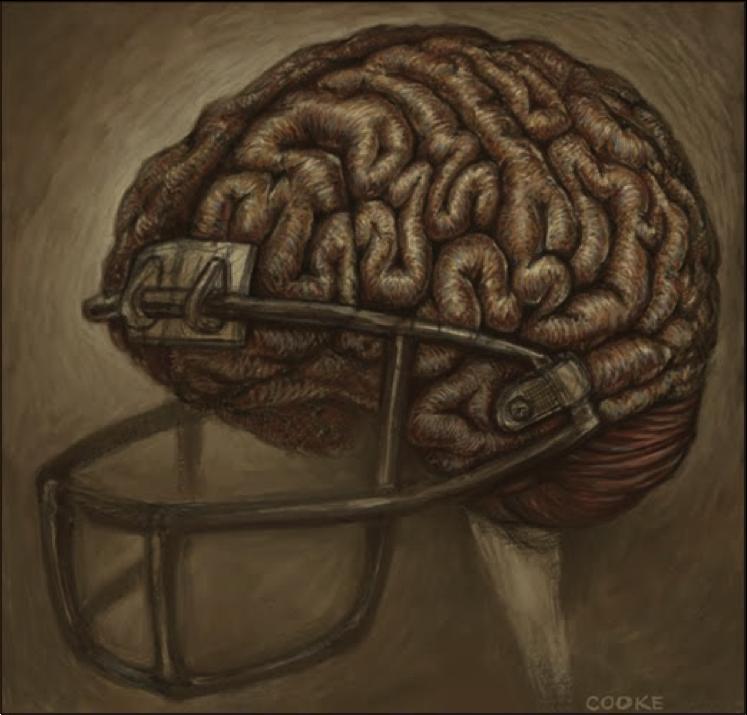 What Is Mild Traumatic Head Injury?