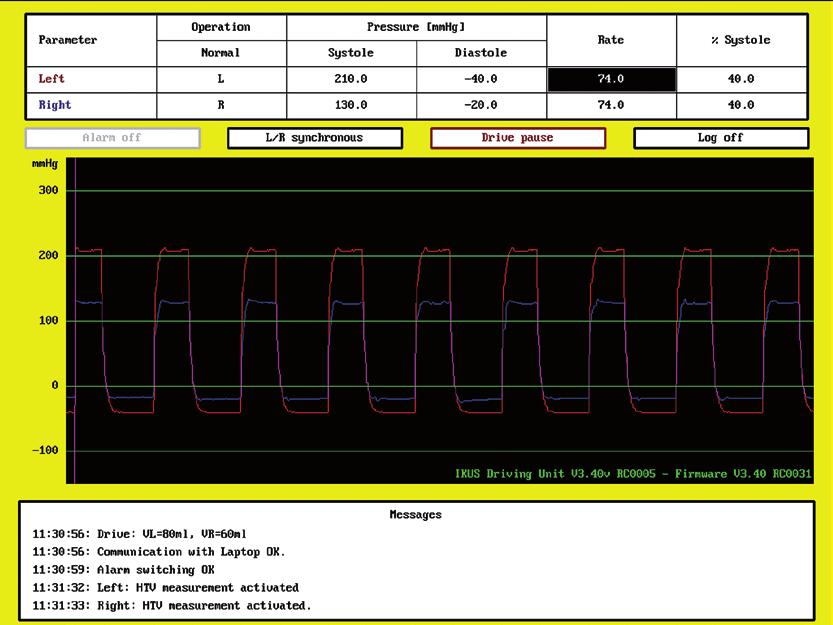 asynchronous or separate pulse operation mode for both ventricles Display allows perfect monitoring of actual drive parameters