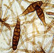 Effective from 1 January 2014 International Rules for Seed Testing 4. Examination After 9 days of incubation, examine plates for Alternaria linicola, Botrytis cinerea and Colletotrichum lini.