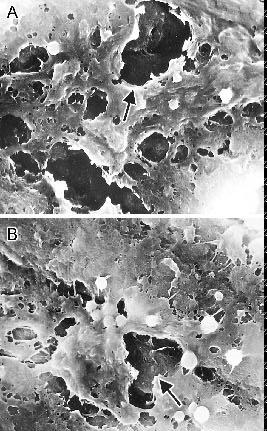 184 Qin LP et al / Acta Pharmacol Sin 2003 Feb; 24 (2): 181-186 Tab 2. Effects of TCFC on TRAP activity of osteoclasts in cultures. n=5. Mean±SD. b P<0.05, c P< 0.01 vs control.