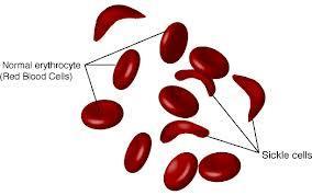 RED BLOOD CELLS (ERYTHROCYTES) Filled with Hemoglobin Protein in blood Fe (iron) atom in