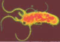 pylori is proved to play an important