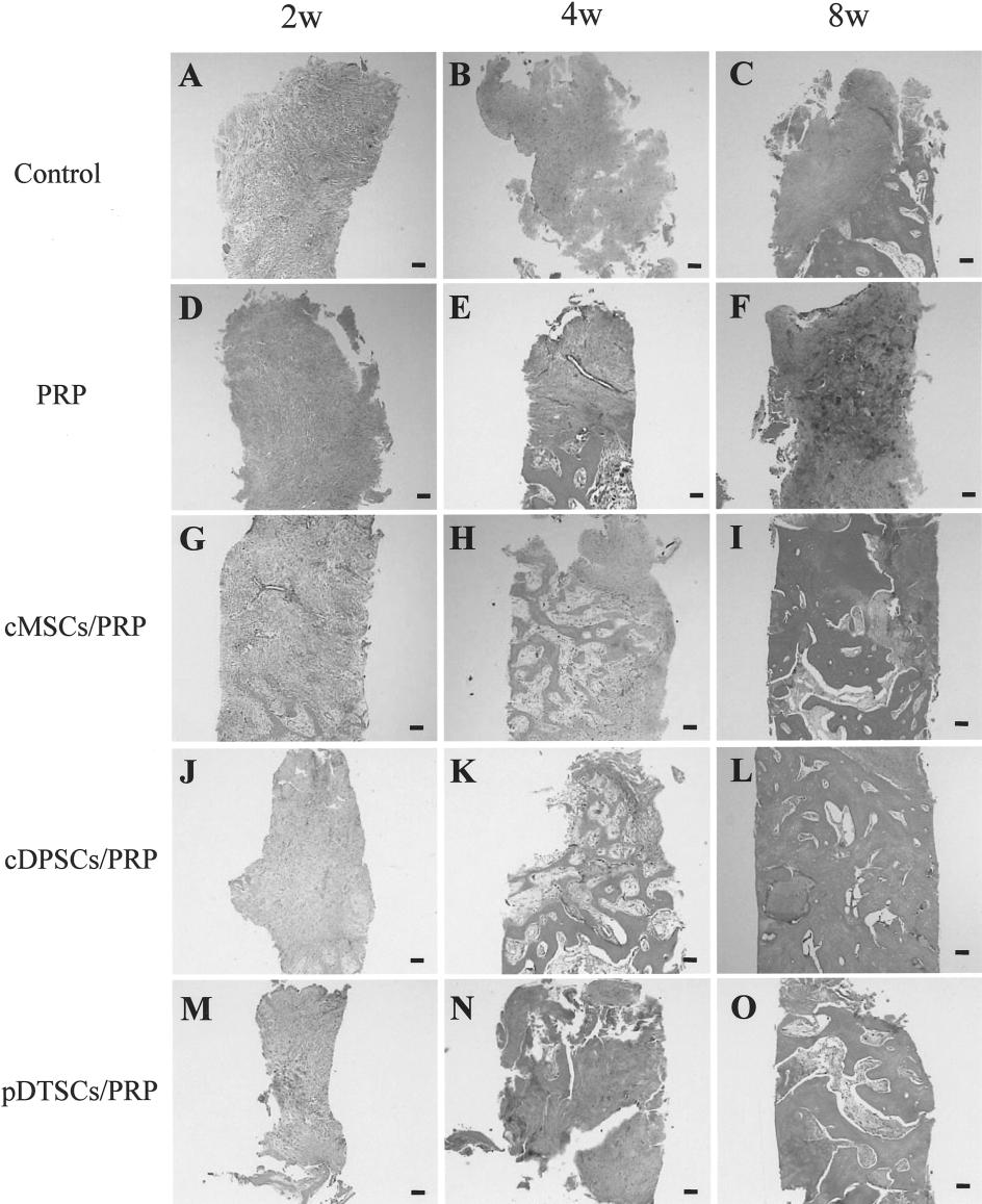 1008 YAMADA ET AL. Figure 3. Histologic evaluation of control, PRP, cmscs/prp, cdpscs/prp, and pdtscs /PRP implantations each week (lower magnification).