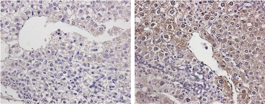 Nm23-M1 wild-type Animal Model Nm23-M1 knockout LPA1 Stained Liver Tumors Nm23-H1: Human