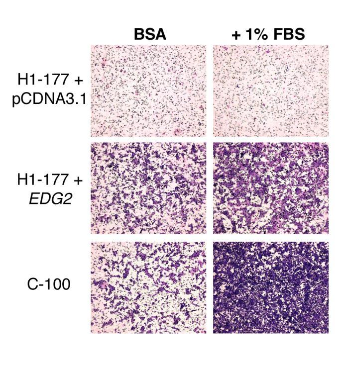 Can LPA1 Restore Motility and Metastasis in Nm23-H1 Suppressed Tumor Cells?