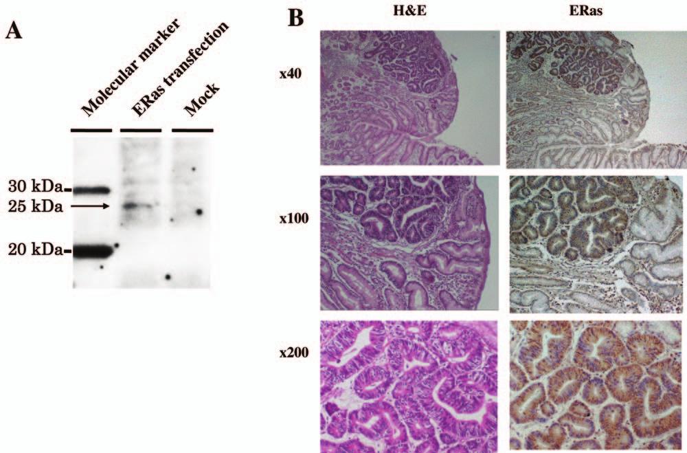 Kaizaki et al: ERas Oncogene in Gastric Cancer Figure 1. A, Western blotting.