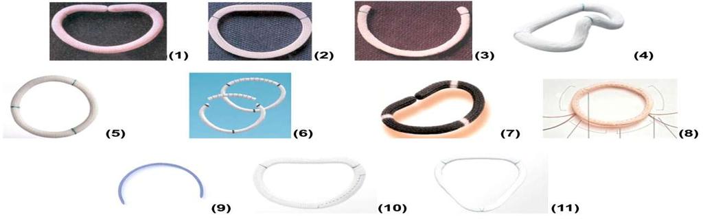 Types of annuloplasty rings (1) Carpentier-Edwards classic annuloplasty rings. (2) Carpentier-Edwards physio annuloplasty ring. (3) Cosgrove- Edwards annuloplasty system.