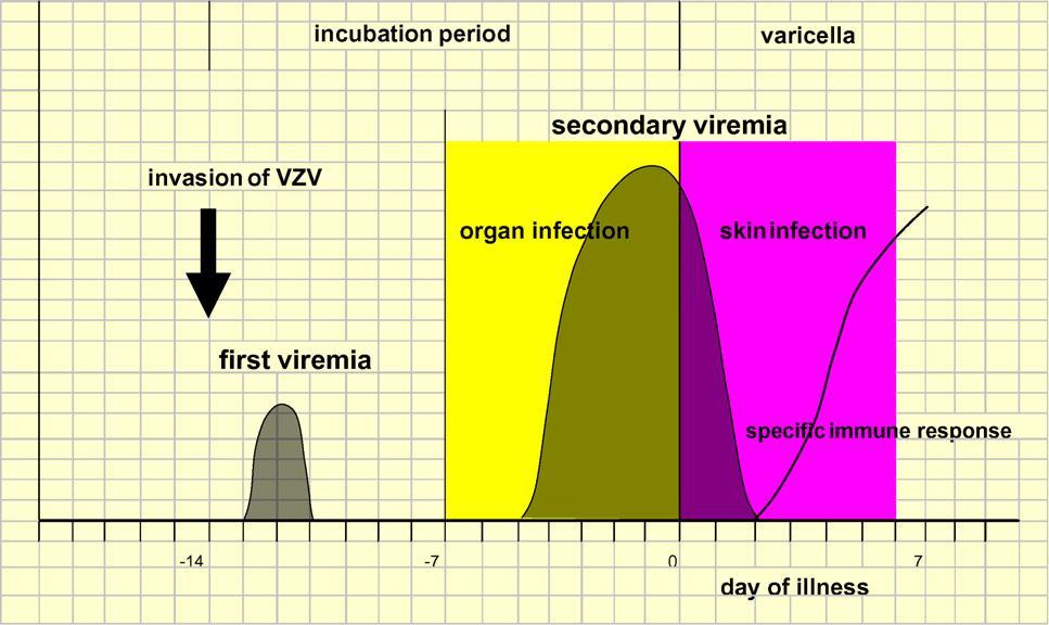 Pathogenesis of varicella Y.