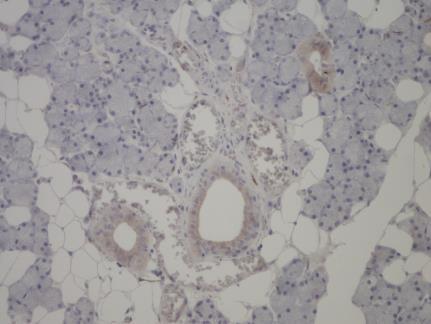 razliku od zdravog moždanog tkiva, gde je izražena. Pored ćelija CNS, GFAP pokazuje senzitivnost za Švanove ćelije, Ćelije glije, tumorske ćelije pljuvačnih žlezda, mioepitelne ćelije dojke.