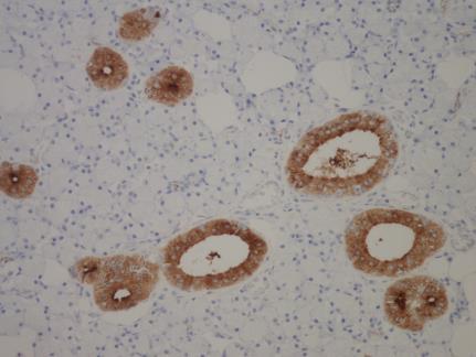 Pokazano je. takođe, da je S100 antigen prisutan u antigen prezentujućim Langerhansovim ćelijama kože.