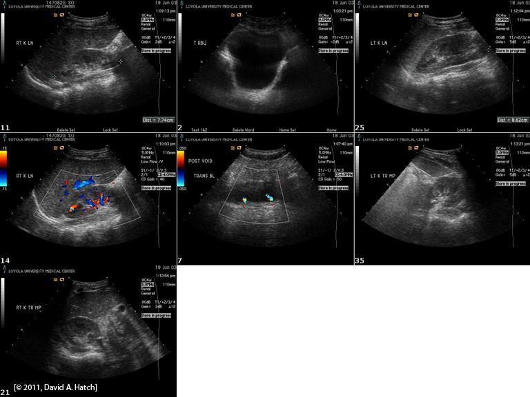 Ultrasound You can learn to read kidney and