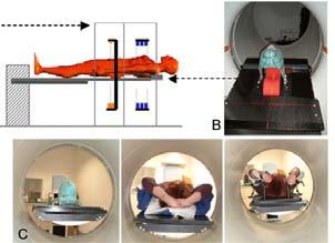 2. Required equipment The PET/CT scanner must be converted into a PET-CT simulator: A specially adapted table