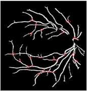 Fig. 4. Suggested mask Fig. 1. Localizing of blood vessels networks nodes Fig. 5. Simulation of blood vessel with predefined diameter for test algorithm Fig. 2.