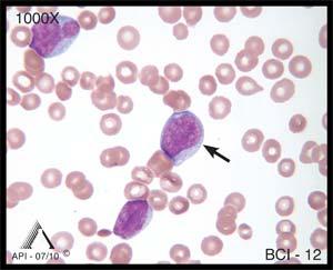 The individual cytoplasmic granules in segmented neutrophils may be hard to differentiate, but their presence contributes to an overall pink color and grainy appearance.